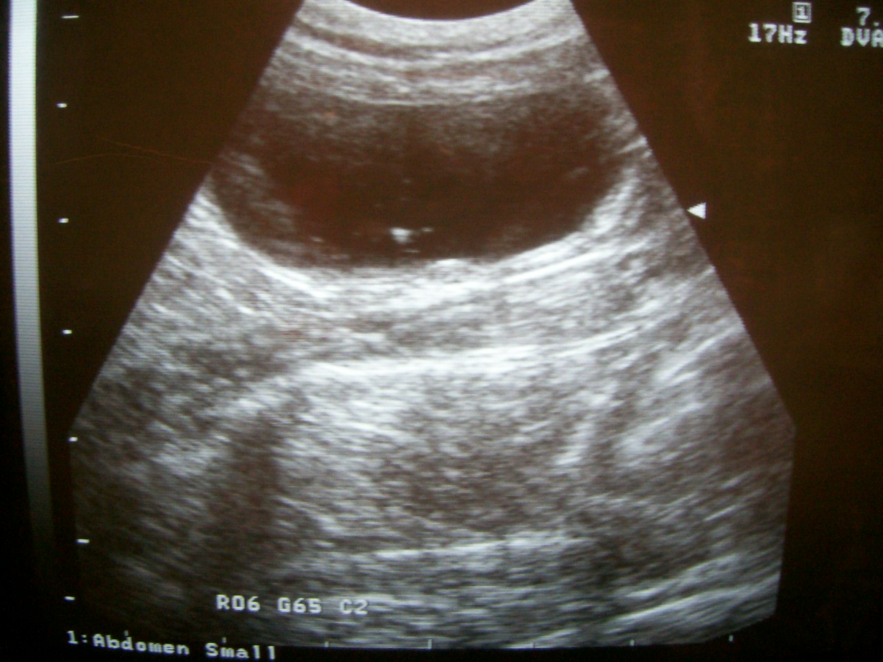 Ultrasound of the Feline Bladder